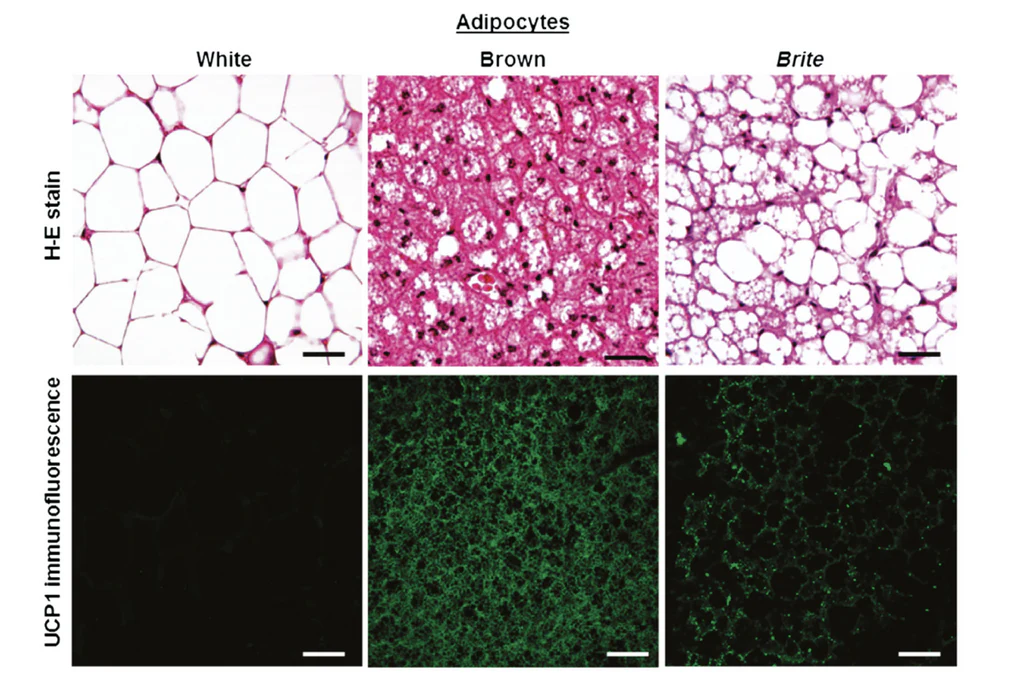 brown fat, white fat, beige fat
