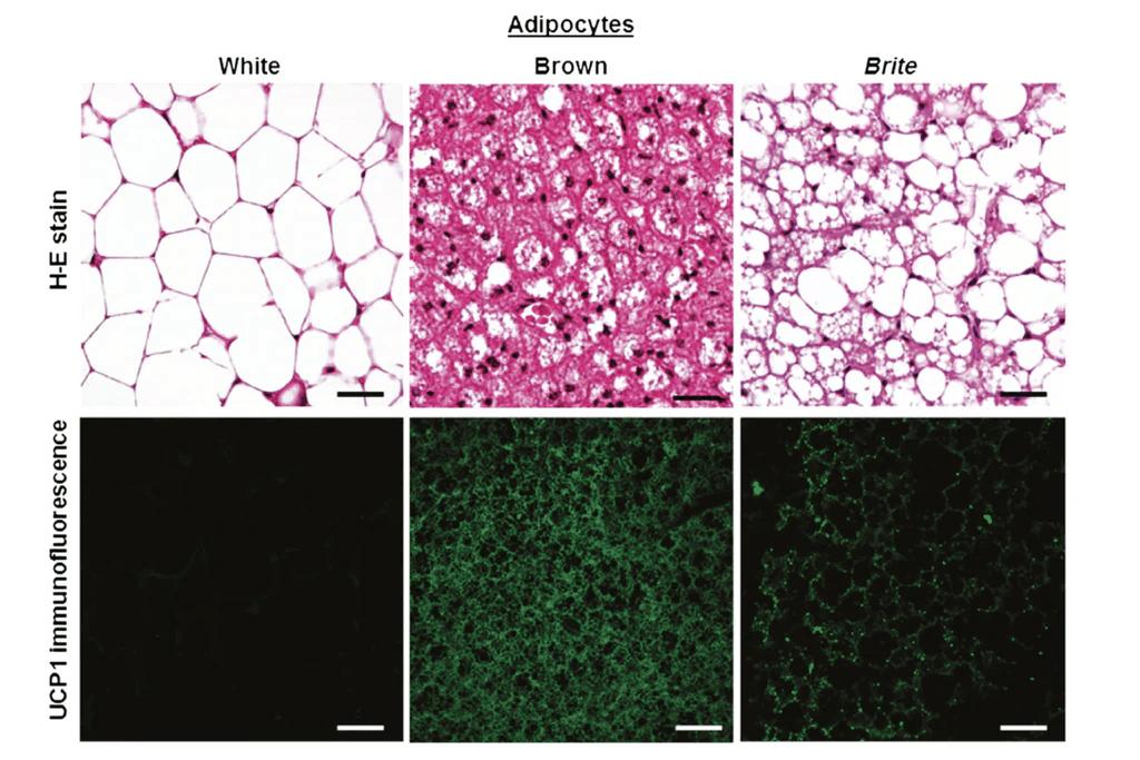 brown fat, white fat, beige fat